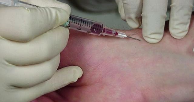 gasometria arterial